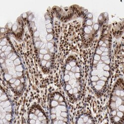 CD23/Fc epsilon RII Antibody, Novus Biologicals:Antibodies:Primary Antibodies